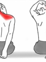 Amikor nem tudod elfordítani a fejed: Mi az a „csomó” a tarkód&nbsp;alatt?